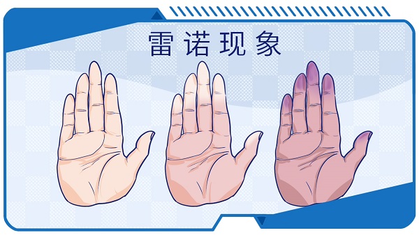 皮硬化是一种什么病的视图